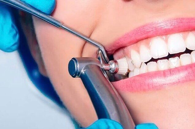 Blanqueamiento dental